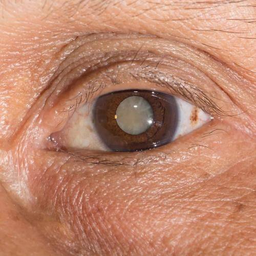 丹东市第一医院眼科真人口碑评价怎么样?