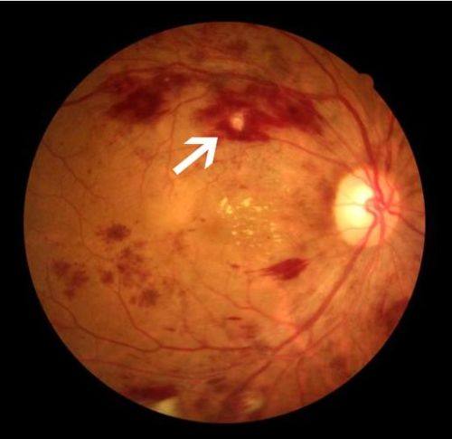 丹东市第一医院眼科详细的预约挂号方式及流程