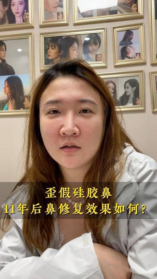 广州嗨斐整形医院真人口碑评价怎么样？