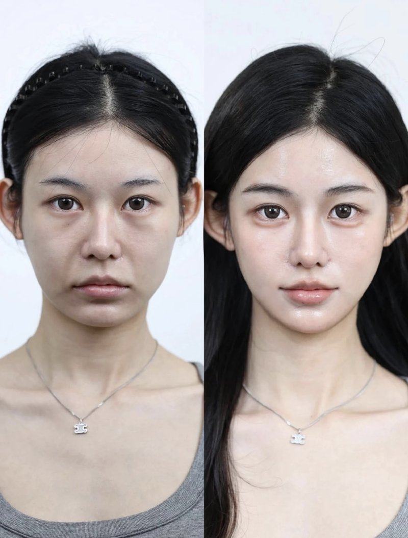 安陆笑笑整形医院详细的预约挂号方式及流程