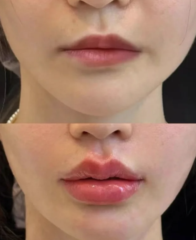 景德镇慕一整形医院详细的预约挂号方式及流程