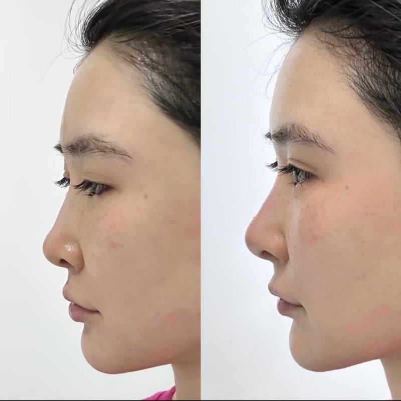 景德镇慕一整形医院地址电话营业时间