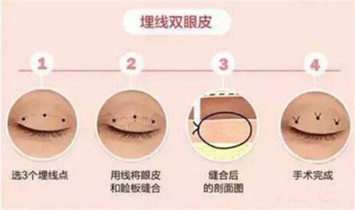 成都武侯伊欣颜轻整形医院地址电话营业时间