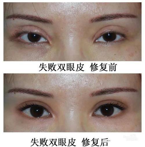 凯里雅典娜医学美容诊所特色项目及技术优势