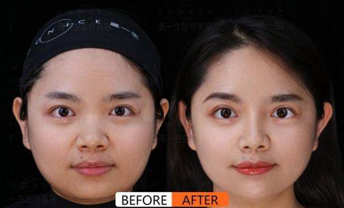 韩国Brandnew整形医院收费价格表/收费标准