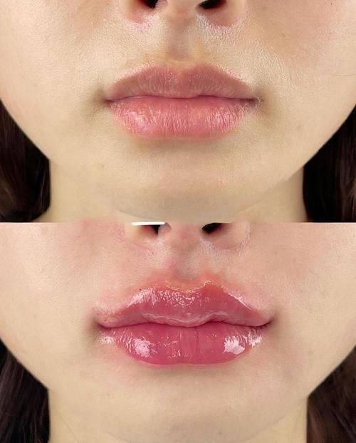 广州韩妃整形外科医院特色项目及技术优势