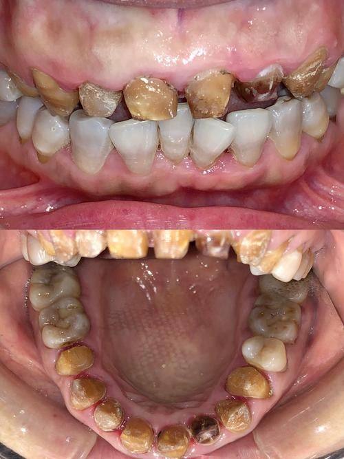 西安鄠邑海涛口腔门诊部真人口碑评价怎么样？