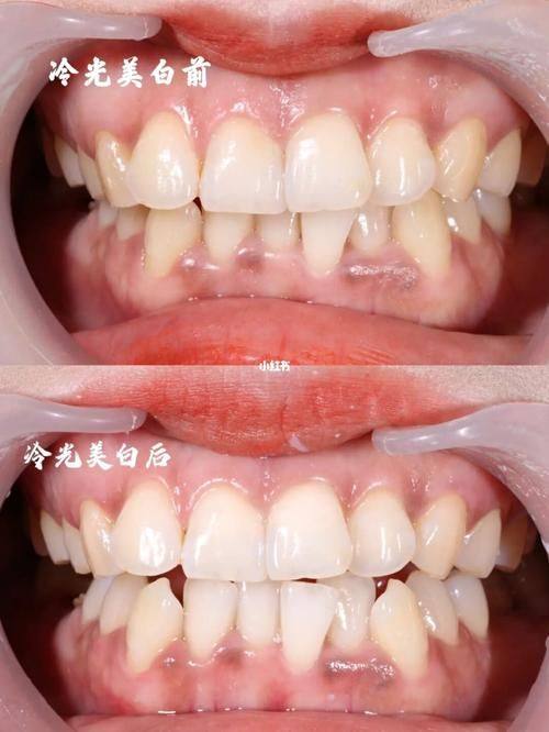 东莞市益美东口腔是正规医院吗？