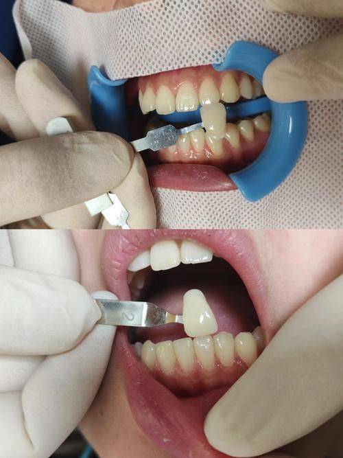 东莞信德过口腔门诊部特色项目及技术优势