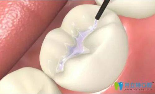 西安鄠邑海涛口腔门诊部地址电话营业时间