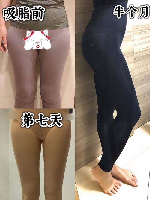 成都武侯伊欣颜轻整形医院收费价格表/收费标准