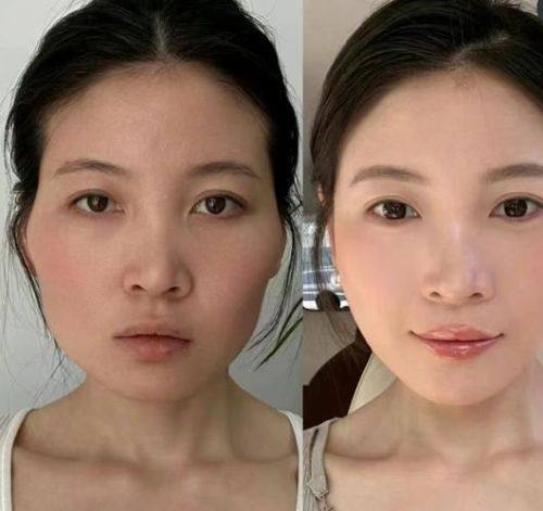 韩国Brandnew整形医院详细的预约挂号方式及流程