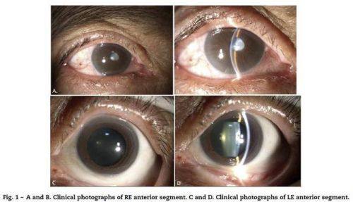 昌吉州人民医院眼科特色项目及技术优势