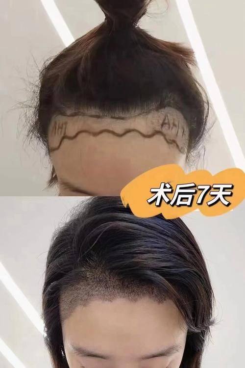 广州韩妃整形外科医院是正规医院吗?