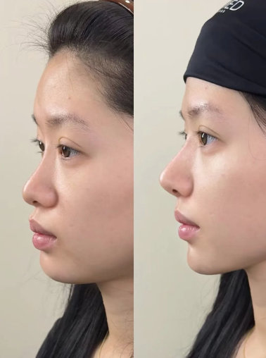 周口烧伤医疗美容医院真人口碑评价怎么样？