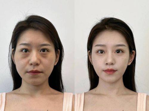 乐昌葆丽医疗美容诊所收费价格表/收费标准