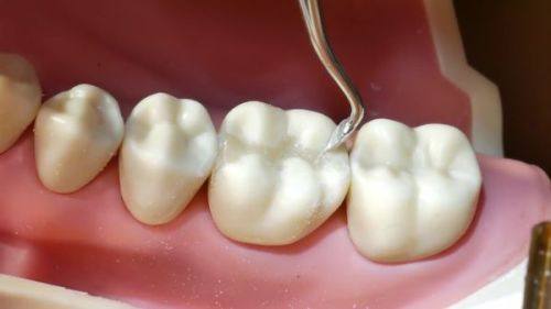 江阴大熊齿科地址电话营业时间