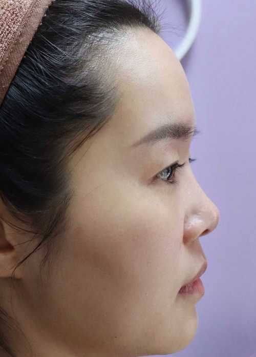 乐昌葆丽医疗美容诊所真人口碑评价怎么样？