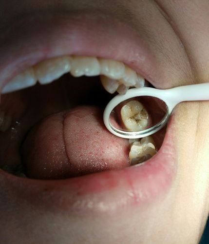 江阴大熊齿科特色项目及技术优势