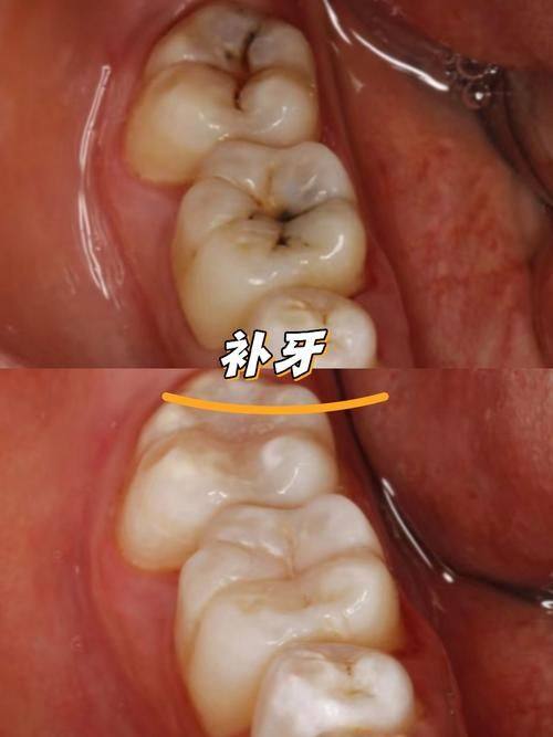 镇江句容牙管家口腔门诊部真人口碑评价怎么样?