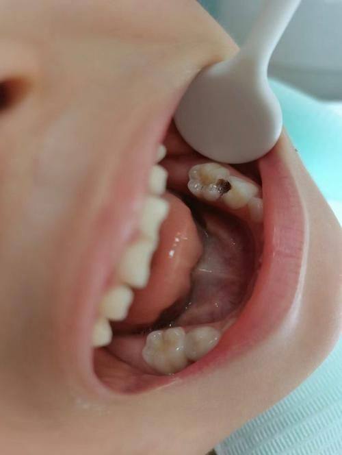 山东济南安美齿口腔诊所是正规医院吗？