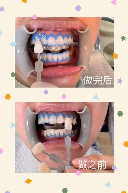 南昌朗朗口腔诊所特色项目及技术优势