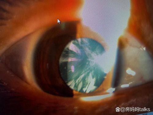 曲靖市妇幼保健院眼科医生团队实力强大及骨干医生简介