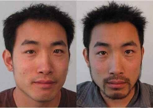 北京瑞丽舍医学美容机构特色项目及技术优势