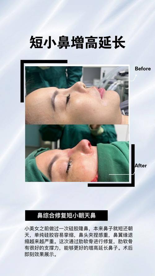 重庆妮杨丝医疗美容诊所特色项目及技术优势