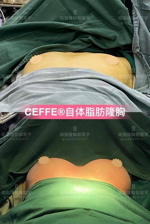 重庆妮杨丝医疗美容诊所真人口碑评价怎么样？