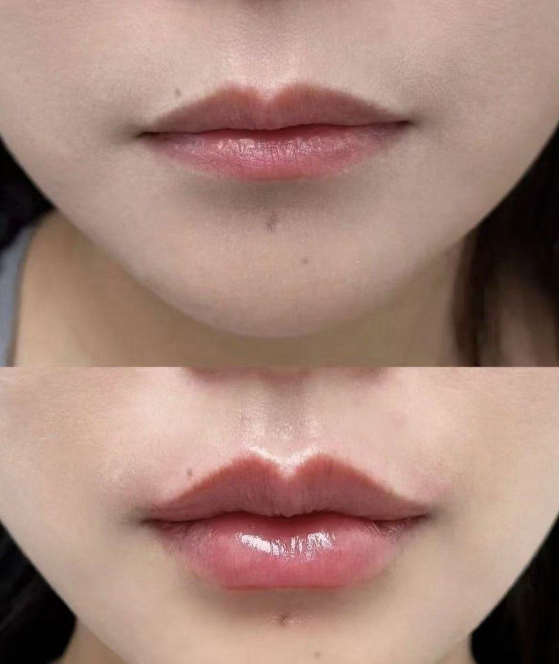 北京瑞丽舍医学美容机构收费价格表/收费标准