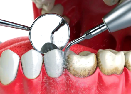 镇江句容牙管家口腔门诊部详细的预约挂号方式及流程