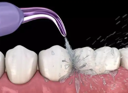 河南周口益冠口腔门诊部特色项目及技术优势